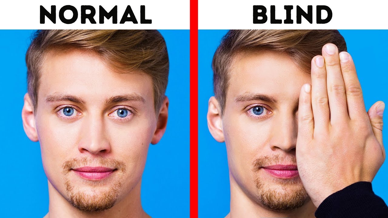 What Do Blind People'S Eyes Look Like? The 8 Top Answers - Barkmanoil.com